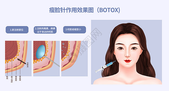 瘦脸针作用效果图背景图片