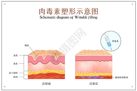 航天日肉毒素塑形医美配图插画