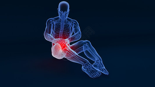 C4D膝关节疼痛场景图片