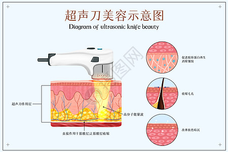 去皱超声刀美容医美配图插画