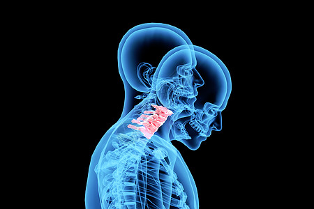 骨关节C4D颈椎病背景设计图片
