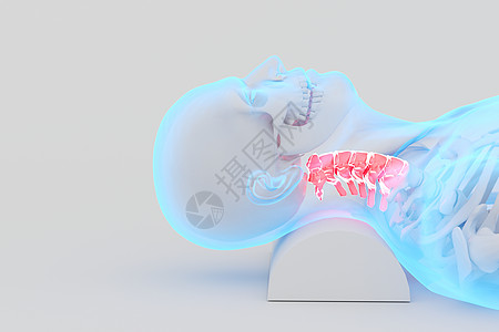 按摩颈椎C4D颈椎疾病设计图片