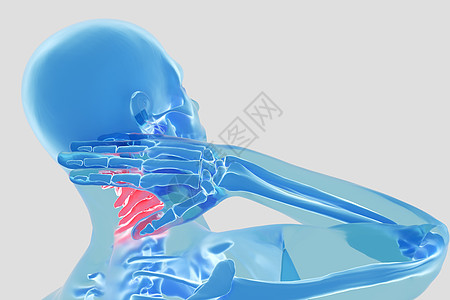颈椎疾病骨质增生错位高清图片