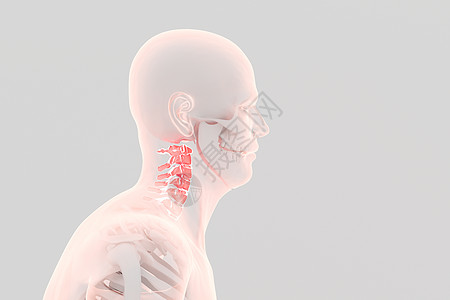 三维颈椎病场景图片