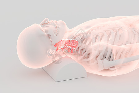 三维颈椎病场景图片