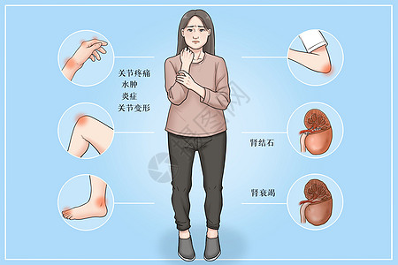 痛风发病状态医疗插画高清图片