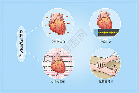 心脏病常见体征医疗插画图片