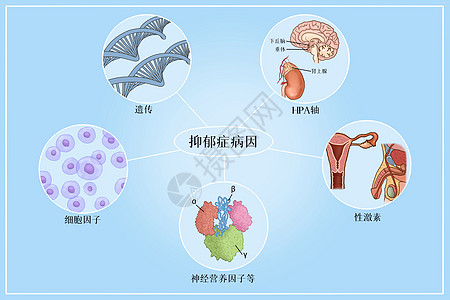 抑郁症病因医疗插画背景图片