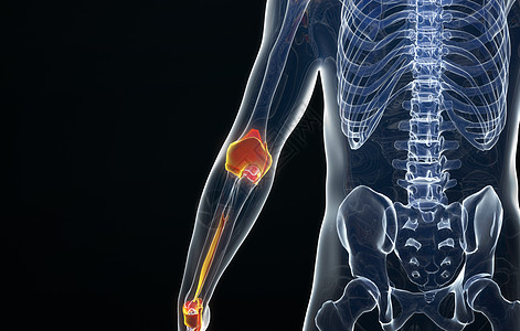 3D人体手臂骨骼模型高清图片
