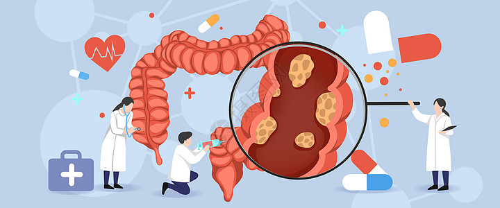 医疗插画肠胃肿瘤图片