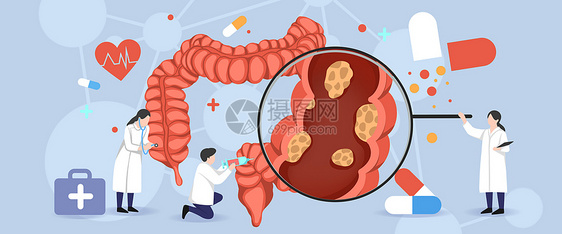 医疗插画肠胃肿瘤图片