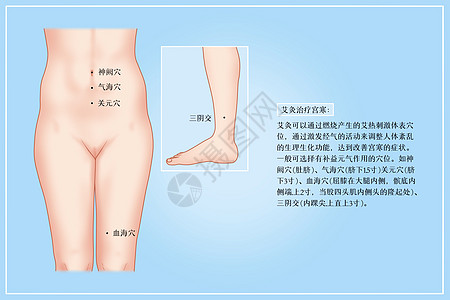 艾灸治疗宫寒医疗插画图片