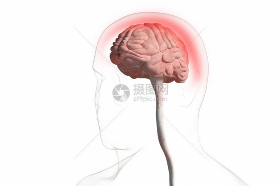 三维脑膜炎场景图片