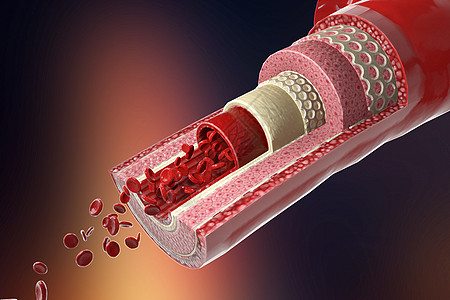 3D血管结构图片