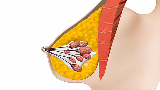 小叶增生乳房横断面设计图片