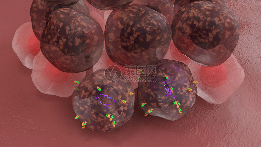 HER2阳性乳腺癌03人类表皮生长因子受体图片
