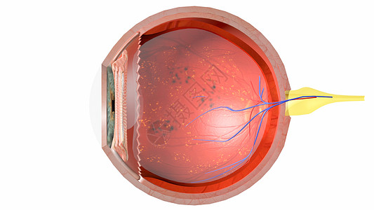 糖尿病眼横断面图片