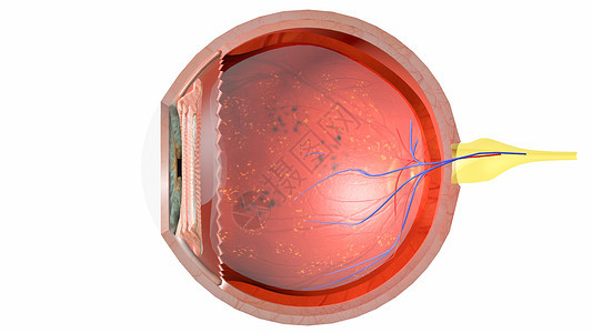 糖尿病眼横断面图片