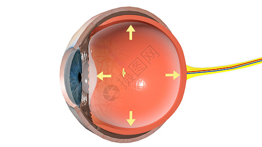 青光眼人体结构右侧高清图片