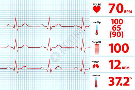 现代心电图显示器显示矢量图背景图片