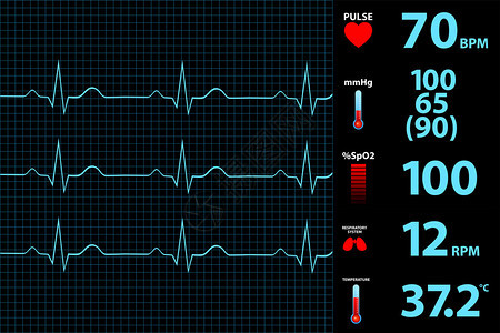 现代心电图显示器显示矢量图背景图片