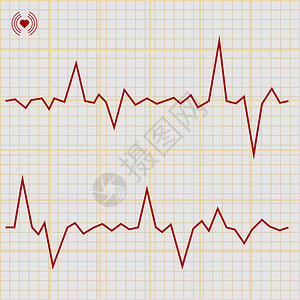 各种心电图设计要素的矢量组健康心脏和心脏停止图片