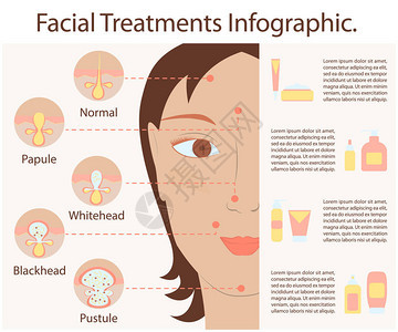 痤疮粉刺的类型人类皮肤海报面部护理信息图表现代平面设计皮脂堵塞毛孔背景图片