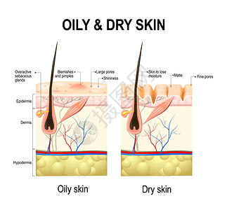 油和干皮肤不同的人类皮肤类型和状况白色背景上人体皮肤的图解剖图片