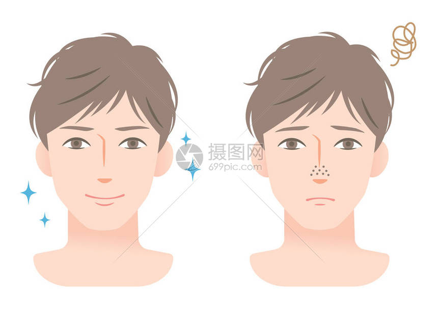 疏通男士脸上的毛孔治疗图片