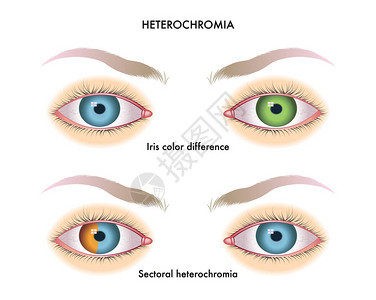 人类眼睛有异地偏图片