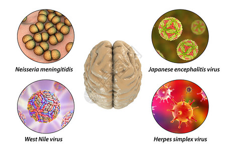 脑感染微生物引起脑炎和图片