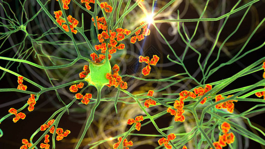 抗体攻击神经元3D插图自动免疫神图片