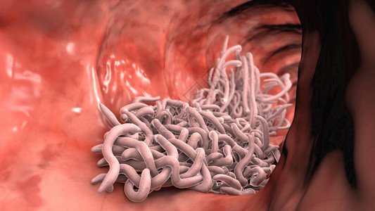 肠道3D图例的润滑液中的寄生虫阿斯卡里图片