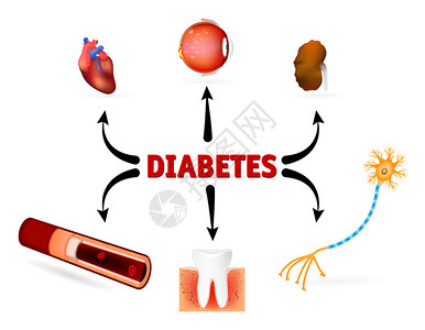 糖尿病并发症图片