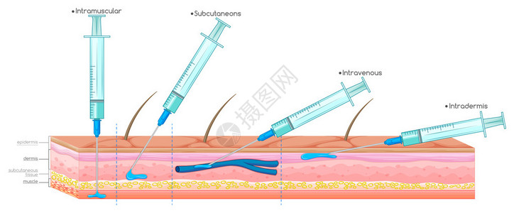 用注射器注射图图片