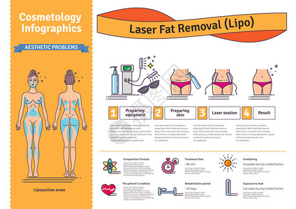 矢量插图集激光脂脂肪切除图片