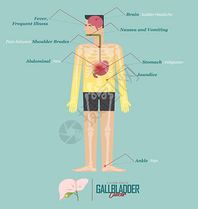 胆囊癌在平面设计中的报警征象胆囊癌疾病症状图标设置与人体骨骼和器官矢量图图片