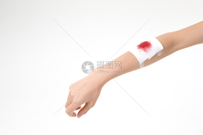 手臂受伤包扎