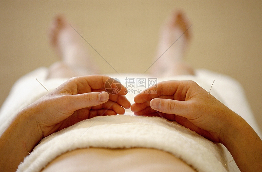 手部针灸高清图片下载-正版图片501465622