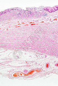 食道图片