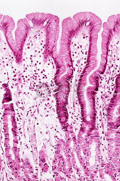 胃粘膜图片
