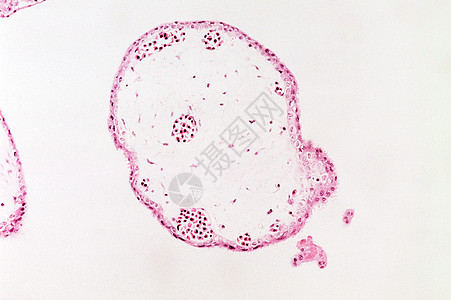 绒毛膜绒毛图片
