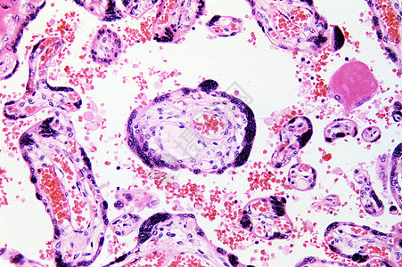 绒毛膜绒毛图片