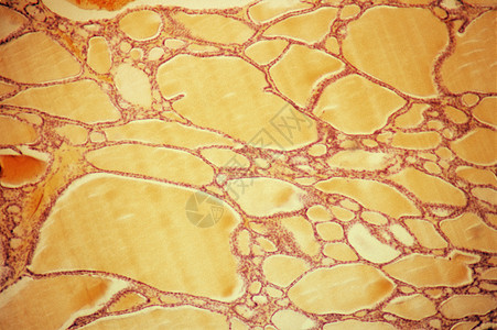 显微镜下的甲状腺胶体滤泡图片