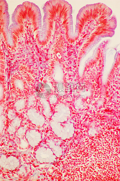 显微镜下的胃幽门区图片