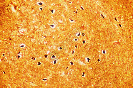 脑干神经细胞图片