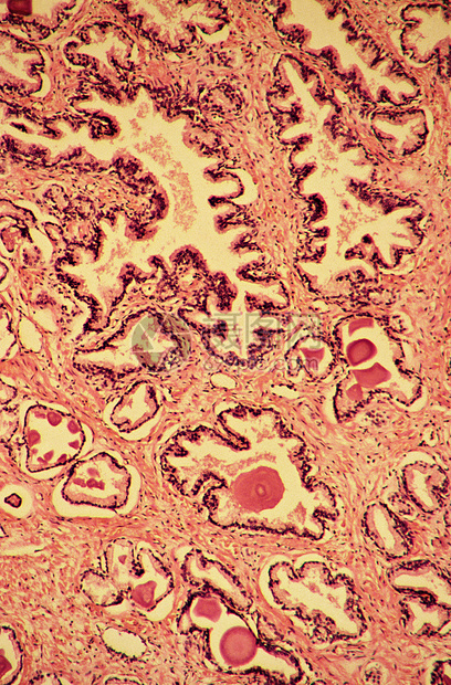 显微镜下的前列腺图片