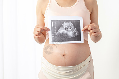 孕妇手拿宝宝b超照片图片