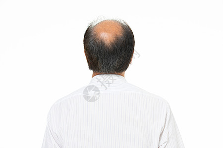 秃顶的中年男性图片