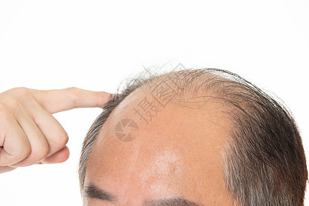 地中海发型秃头的中年人背景